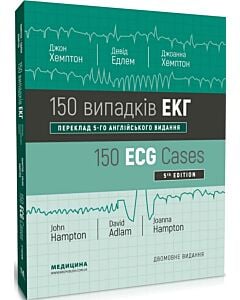 Фото - 150 випадків ЕКГ = 150 ECG Cases